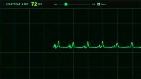 Claude Sonnet 5, Raw API (one-shot): 016 Heartbeat Line